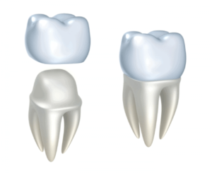 Different types of crowns and dental crowns porcelain crowns zirconia crowns