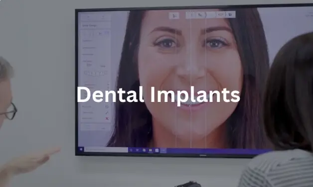 dental implants brisbane