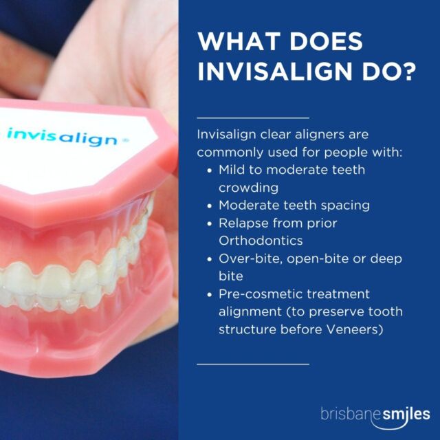 Straightening your smile has never been more discreet! 😁

Did you know we offer Invisalign at Brisbane Smiles? Say goodbye to traditional braces and hello to clear, custom aligners that fit seamlessly into your lifestyle.

Experience the freedom to eat what you want and maintain your oral hygiene with ease 🙌

Ready for a confident, aligned smile? Schedule your Invisalign consultation today by calling 3870 3333 or booking online via our bio link

#BrisbaneSmiles #Invisalign

⚠️Individual results will vary. All minor and major dental treatments have risks. Please seek the advice of a qualified healthcare professional before proceeding.