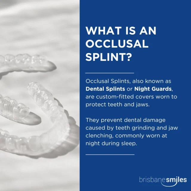 Discover the comfort and protection of Occlusal Splints! 💙

Custom-made to fit your smile, these innovative devices provide relief from jaw pain and prevent teeth grinding, also known as bruxism.

Ready to experience relief? Book your consultation today via the link in our bio or call our team on 3870 3333 🦷

#brisbanesmiles #dentist #brisbane